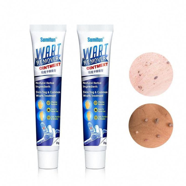 Wart Remover Ointment for Wart Removal